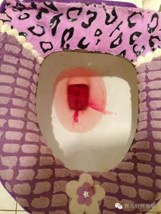 新生儿浑身发紫口吐白沫,新生儿口吐白沫死亡