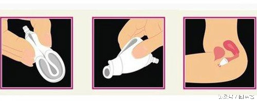 除了卫生巾还有什么经期用品,卫生巾新科技