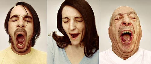 脑血栓以后为什么打哈欠手脚会动,老是打哈欠是中风前兆吗