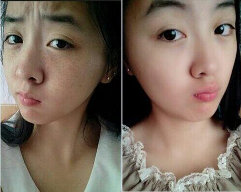 老师讲解祛斑技术的文案,祖传中医教你如何祛斑