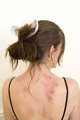 刮痧的正确讲究,刮痧的方法及注意事项