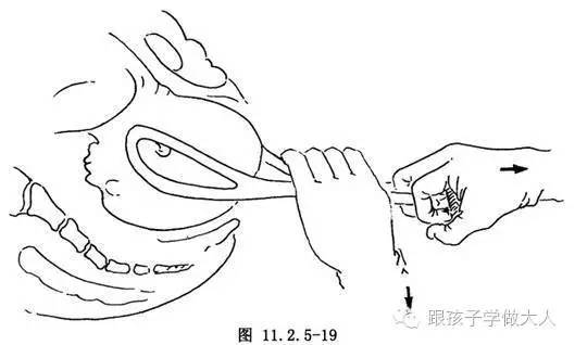 准妈产检生产都用过这些冰冷医疗仪器，看的心惊肉跳！