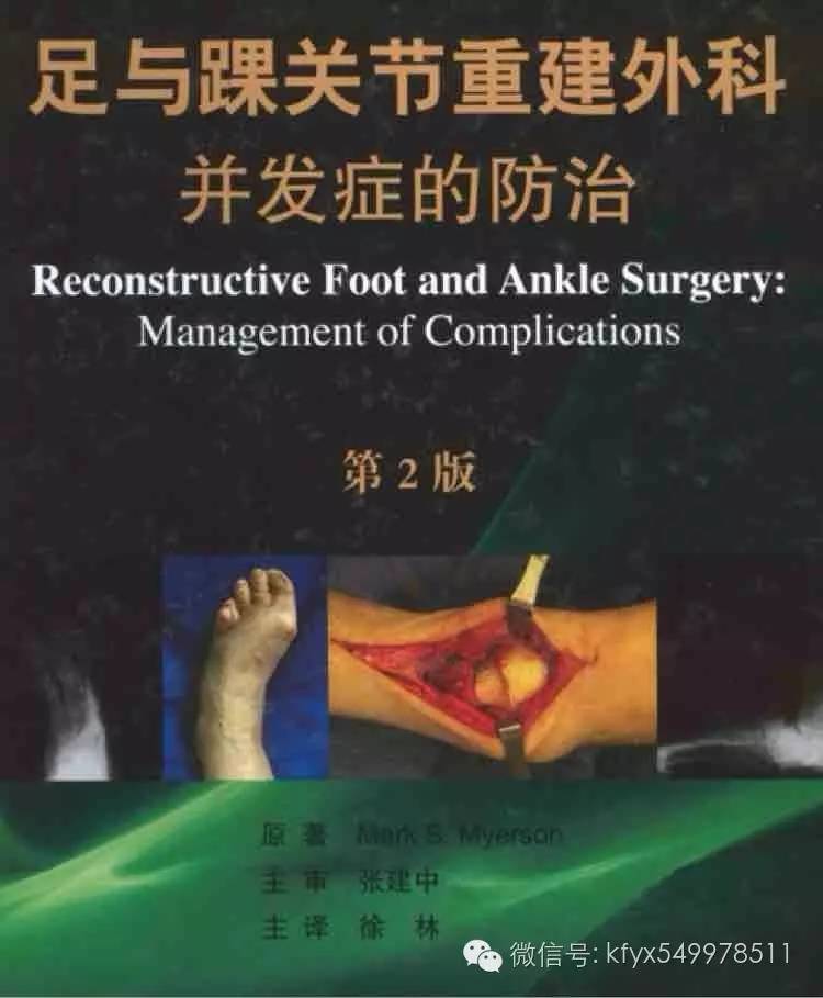 肌筋膜疼痛处理最全宝典,肌筋膜疼痛症是纤维肌痛吗