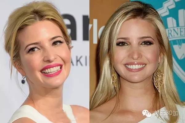 新美容|唇膏买嗨了,可你的牙配得上这些唇膏吗?