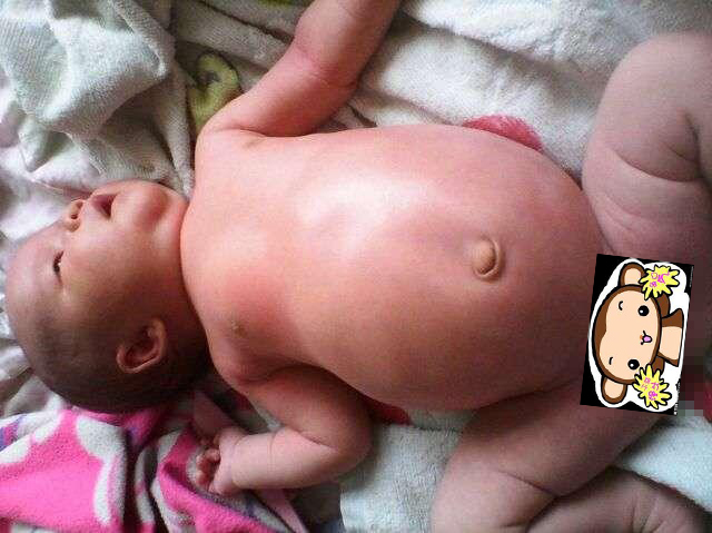 好奇肚子里的宝宝,宝宝有个圆圆的肚子是什么原因