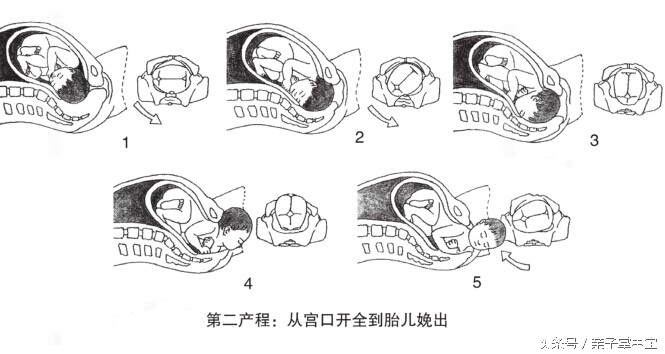 产妇急产危害,产妇分娩时会遇到哪些危险