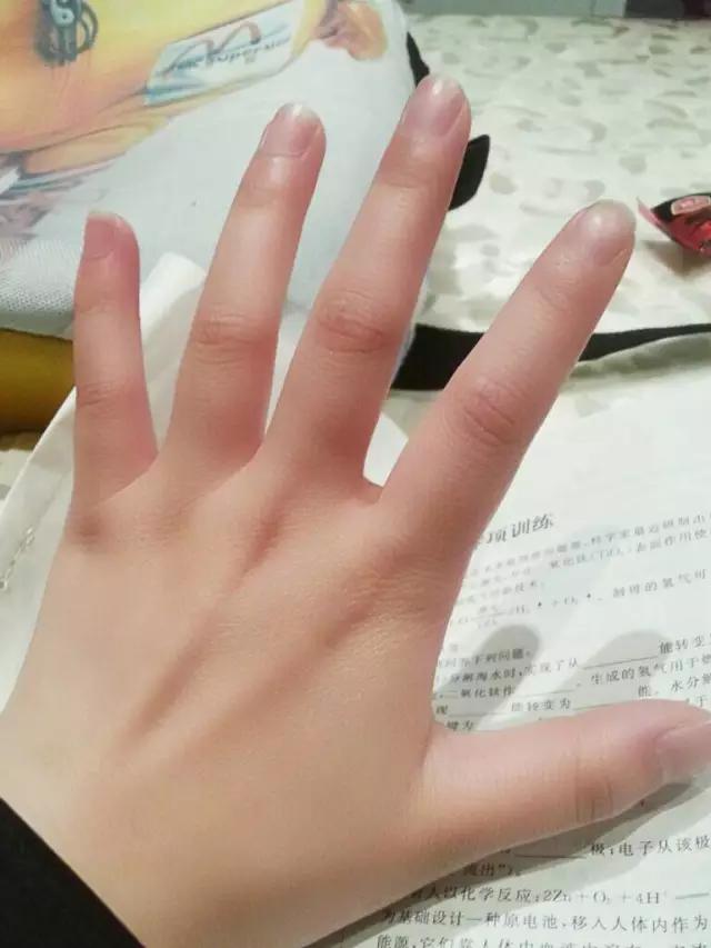 网络热传治冻疮良方，你一定用得着！