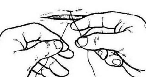 女性结扎以后复通手术全过程,女性结扎的手术步骤