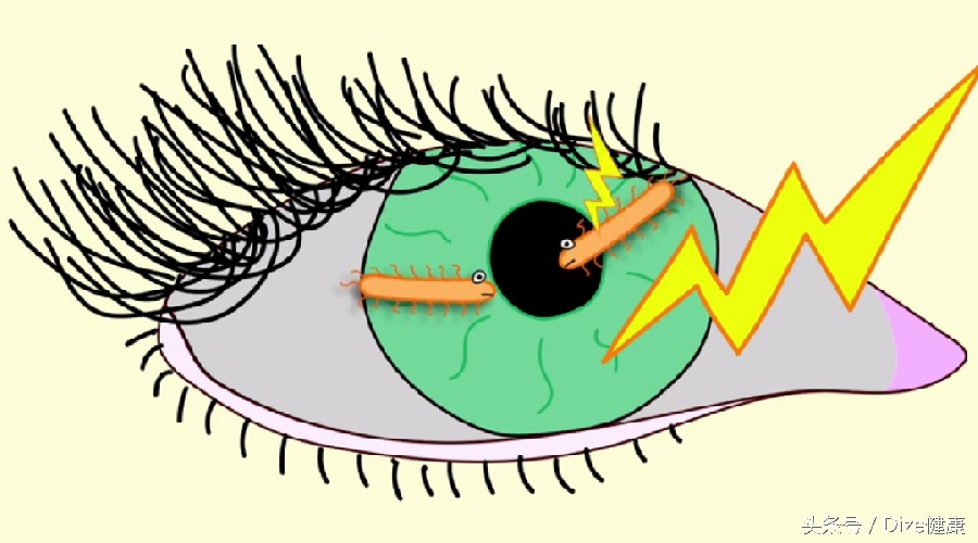 隐形眼镜戴久了干涩怎么解决,隐形眼镜戴久了干涩用什么药