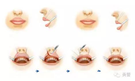 唇唇欲动攻略,唇部拯救你的唇形