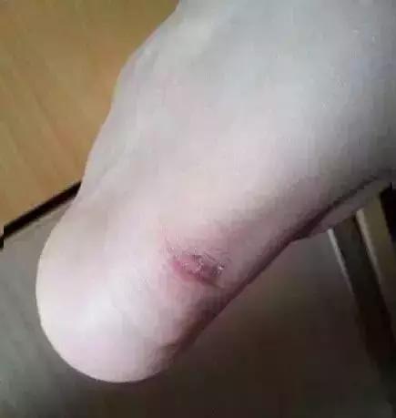 高跟鞋凉鞋磨脚怎么办,高跟鞋磨脚后跟怎么处理
