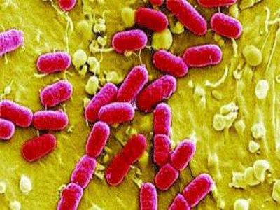 大肠杆菌传染给宝宝导致早产,早产儿小肠结肠炎存活几率