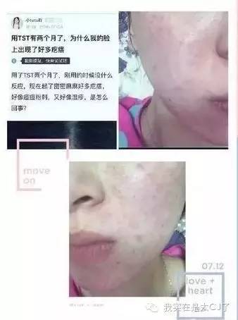 张庭现身微商宣传活动,张庭最新微商消息