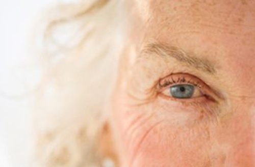 白眼球突然红了怎么处理,白眼球有一小部分变黄