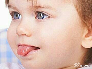 宝宝鹅口疮怎么治最有效,宝宝患有鹅口疮不要急