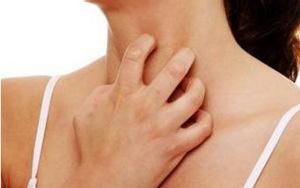 麻疹能治断根吗,麻疹治得好吗