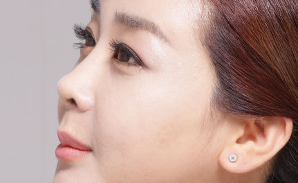 大鼻子不好看咋办,大鼻子好看还是小鼻子好看