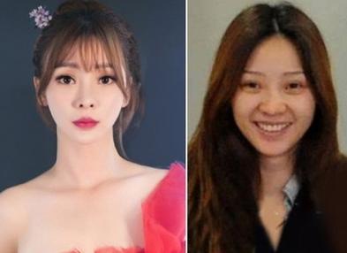 法令纹这么显老得如何搞定,最显老的法令纹解决方法