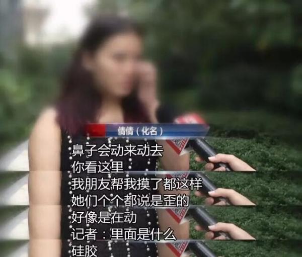 女子花8000多隆鼻竟嫌效果太自然,隆鼻多次失败