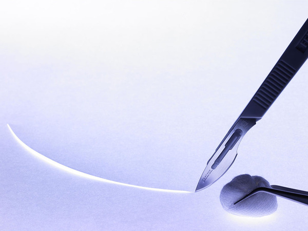 癫痫义诊活动简报,难治癫痫手术前准备