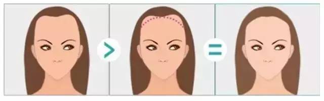 发际线决定人的智商,发际线决定气质