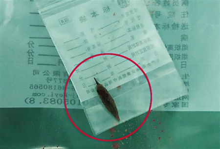 小孩误吞小枣核有什么补救方法,2岁小孩误吞枣核