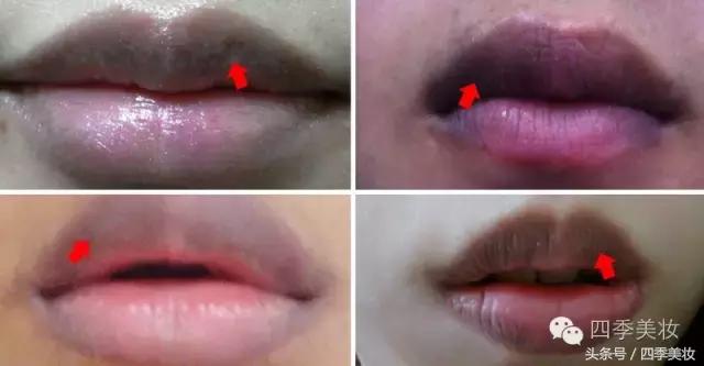 防嘴唇干裂脱皮最好的方法,唇部脱皮干裂推荐什么面膜