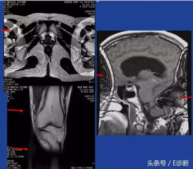 磁共振伪影及解决方案,e系列诊断