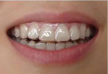 牙齿纹身设计,脖子镶钻纹身