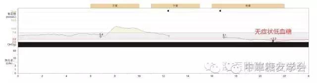 最好最精确的血糖监测仪,监控血糖软件