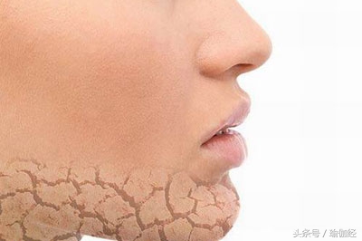 正确喝水注意这3点,正确喝水时间表教你越喝越瘦