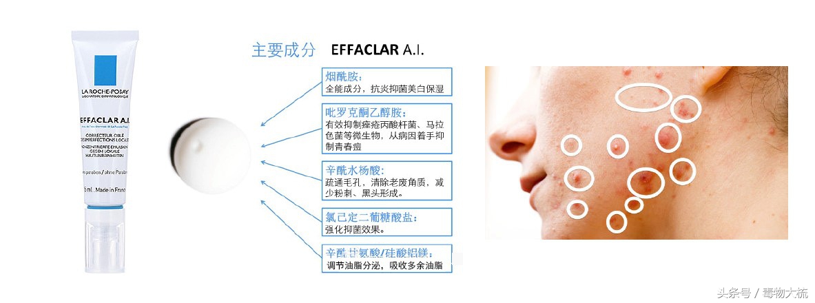 祛痘打假测评,祛痘产品良心测评打假