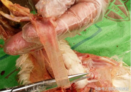 感冒和腺肌胃炎的混感治疗方案