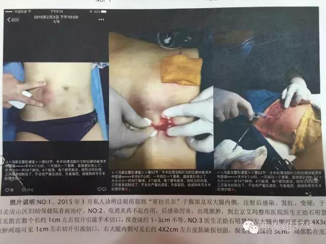 留学生被骗十多万,留学生代购被骗