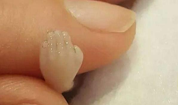 人工流产胎儿医院怎么处理,人工流产胎儿最后如何处置