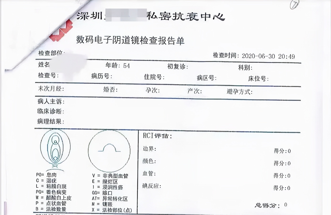 女子想变“紧”，结果价值几十万的“*处私**整形”项目哪哪都有问题！