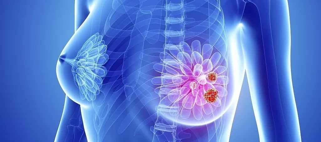 女40岁乳腺增生轻微的要吃药吗,35岁女孩乳腺增生严重吗