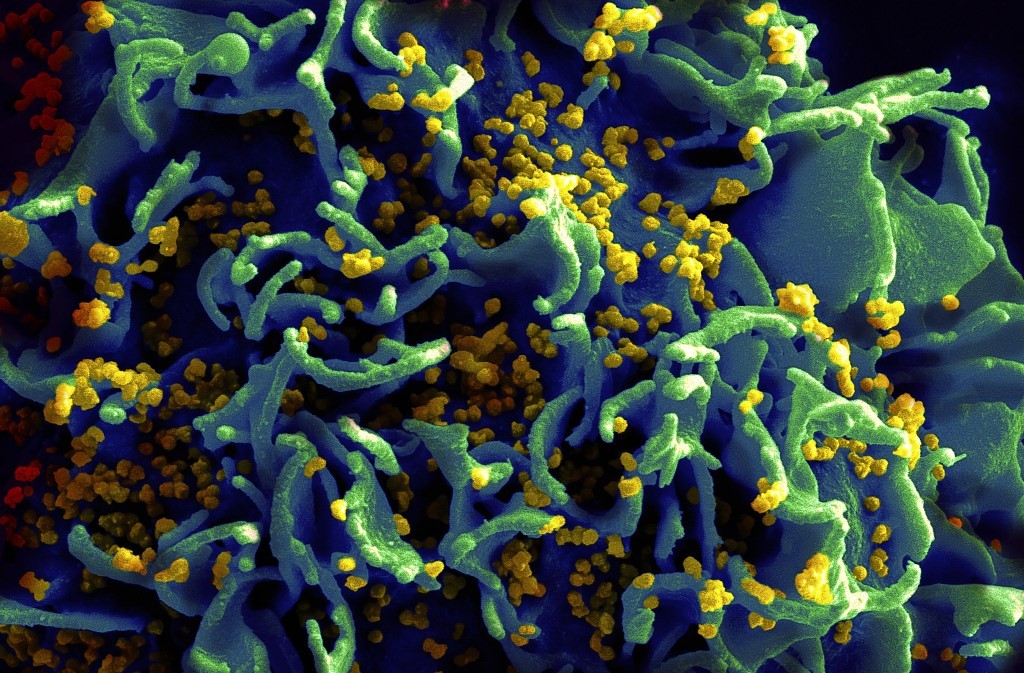 这种治愈癌症的新技术CAR-T，被改造后有望攻克艾滋病