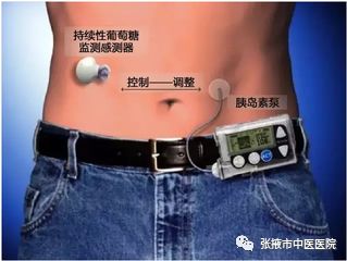 2020年糖尿病义诊活动,糖尿病患者义诊活动