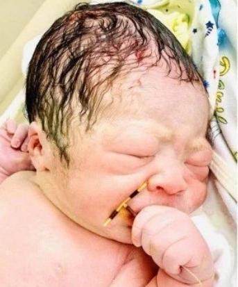 节育器避孕应在月经多少后放置,节育器是如何起到避孕效果的