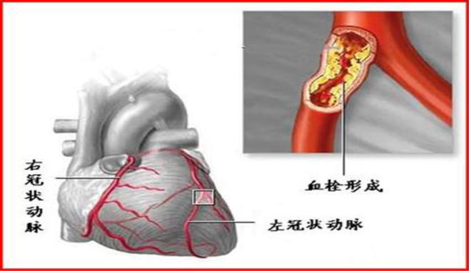 汉邦古中医教学视频,中医心脏急救穴位针灸