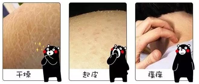 用了身体乳皮肤变好,用了身体乳皮肤特别嫩