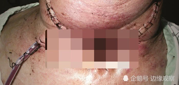 韩国烟包装为什么那么吓人,韩国新型香烟