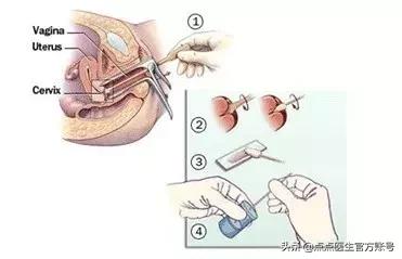 50-60岁体检套餐还是自选划算,女性体检套餐检查项目怎么选