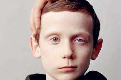 为什么人会一边脸大一边脸小,感觉一边脸大一边脸小是怎么回事