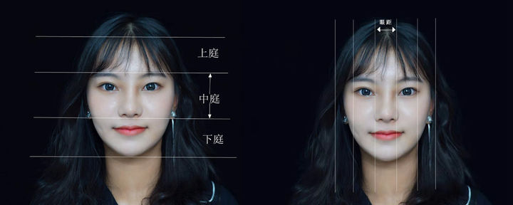 做外眼角改变到底大不大,开外眼角的手术后的图片