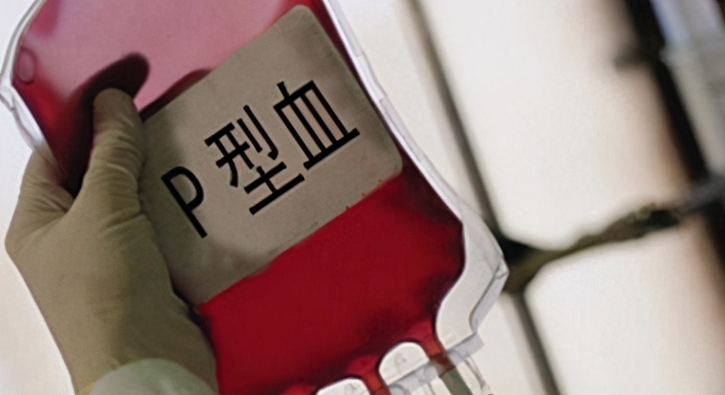 世界上只有一例的罕见血型,南京罕见血型