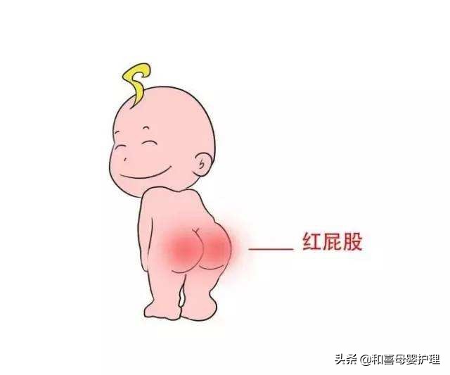 宝宝红屁股怎么办最有效的方法,解决宝宝红屁股的最快办法