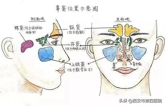 儿子鼻塞流脓鼻涕是鼻窦炎吗,孩子鼻窦炎流脓鼻涕伴有咳嗽