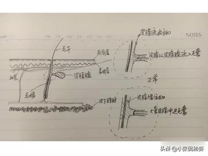 去黑头粉刺痘痘的面膜推荐,男士清洁面膜推荐去黑头收缩毛孔